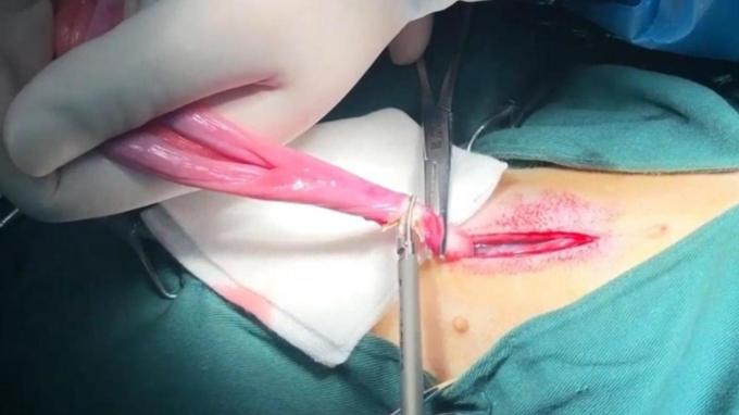 najnowsza sprawa firmy na temat Używanie skalpela ultradźwiękowego dla zwierząt domowych w chirurgii kotów i kastratów | Surgsci  0