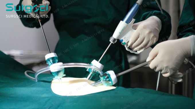 najnowsze wiadomości o firmie Miejsca nacięcia trokaru | SurgSci  0