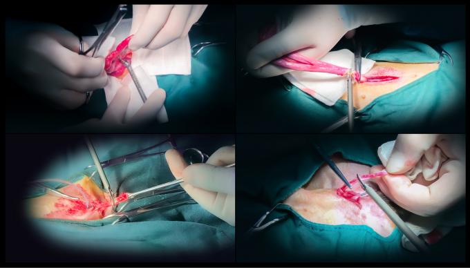 Chirurgia laparoskopowa Ultradźwiękowy system skalpela Hemostaza do użytku weterynaryjnego 6