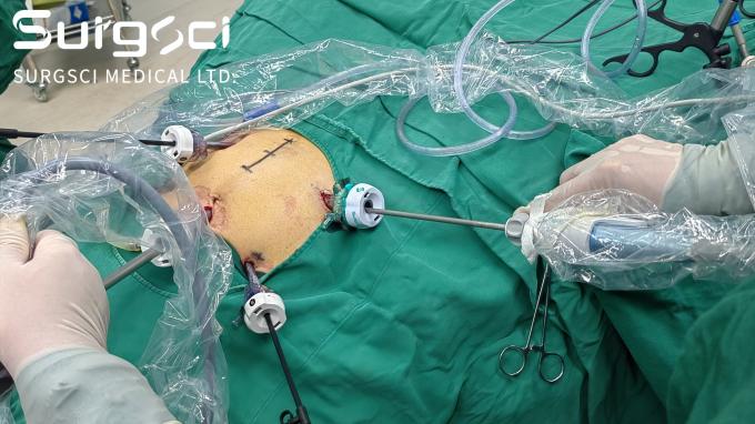 najnowsze wiadomości o firmie Zostań naszym dystrybutorem w swoim kraju | SurgSci 0